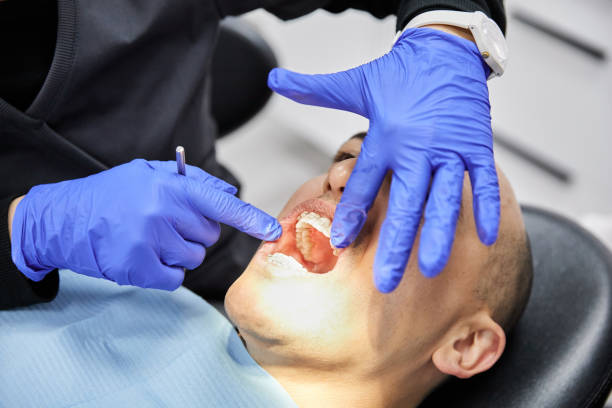 Best Dental Abscess Treatment in West Springfield, VA